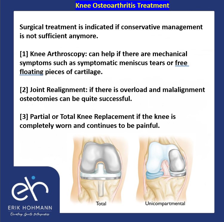 Knee Arthroscopy