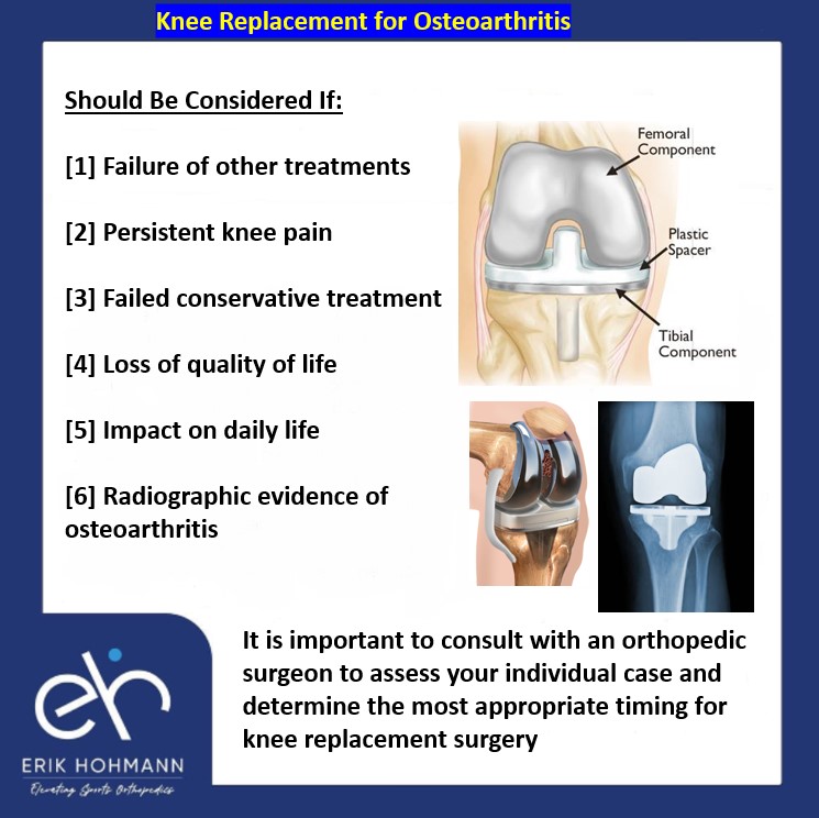Knee Replacement for Osteoarthritis