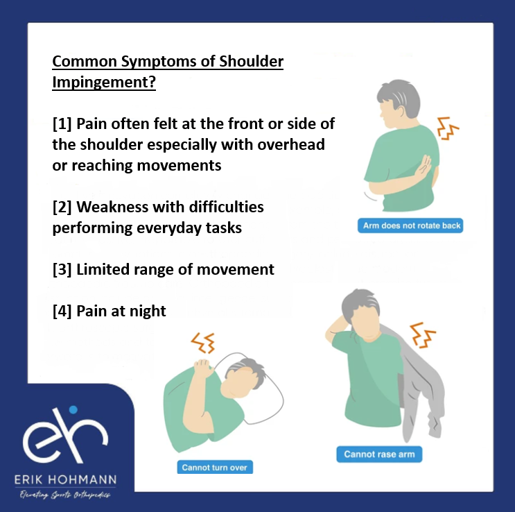Common Symptoms of Shoulder Impingement?