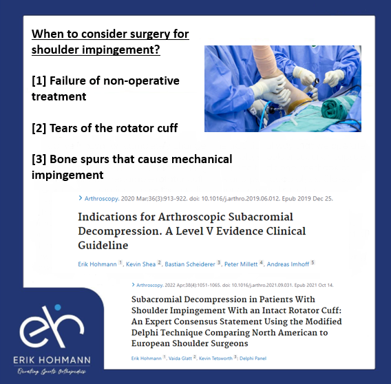 When to consider surgery for shoulder impingement?